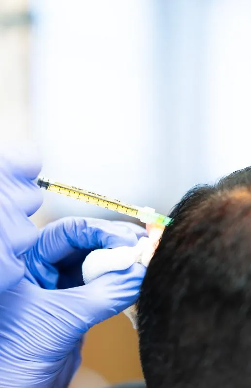 utredning av håravfall trygg utredning och behandling i göteborg