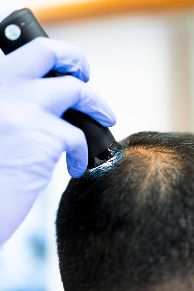 prp-behandling göteborg utredning av håravfall