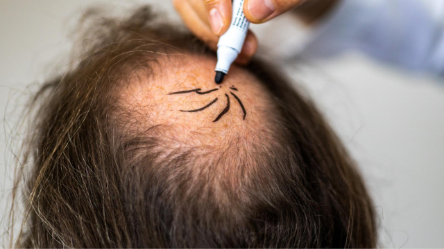 prp-behandling göteborg prp-behandling i göteborg