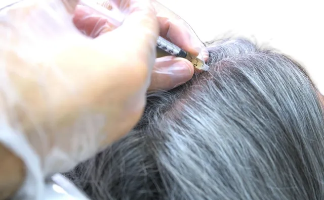 boka tid för behandling av håravfall behandling av håravfall