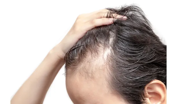 behandling mot håravfall behandling av håravfall