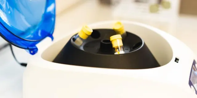 prp vid håravfall prp