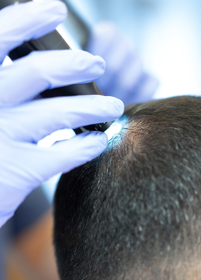 hårklinik göteborg hårklinik i göteborg